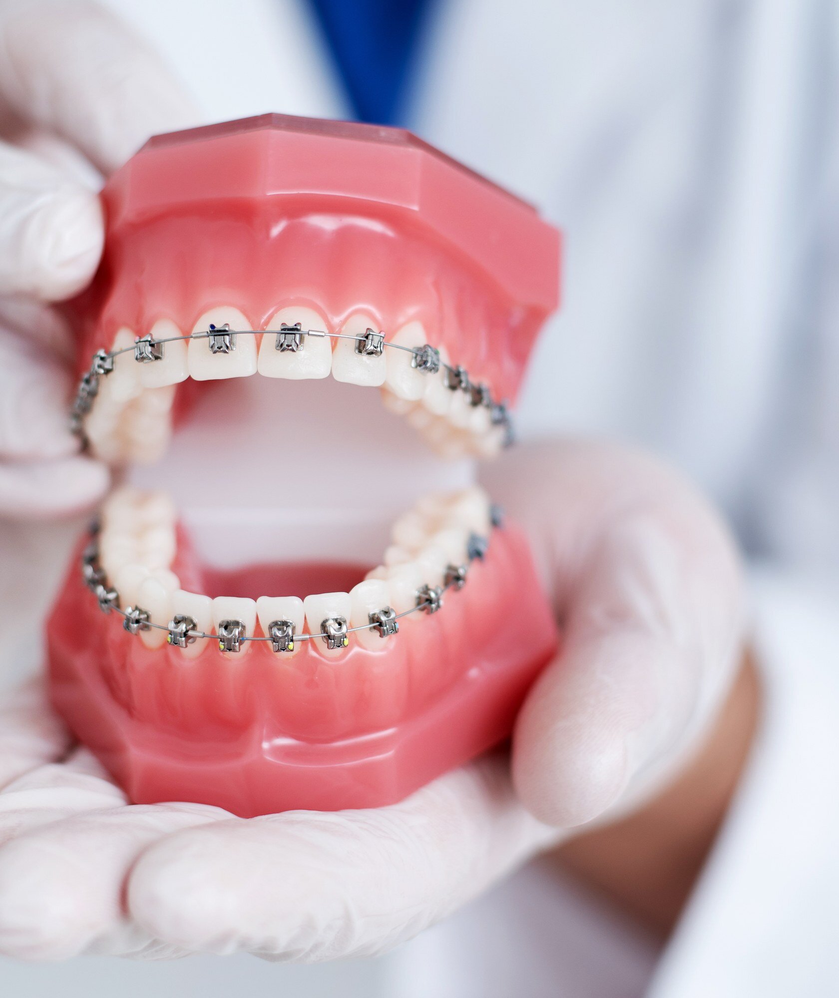 Orthodontist holding a model of teeth fitted with braces